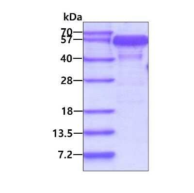 SDS-PAGE: Recombinant Human NAP1L1 His Protein [NBP1-72537]